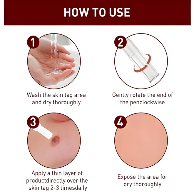 Advanced Skin Tag & Mole Remover - Professional Strength Treatment (Buy 1 Get 1 Free)