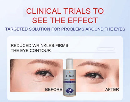 Lutein Anti Wrinkle Essence Oil 60 ml Buy (🔥Buy 1 Get 1 Free🔥)(⭐⭐⭐⭐⭐ (4.9/5) RATED BY 10,000+ CUSTOMERS)