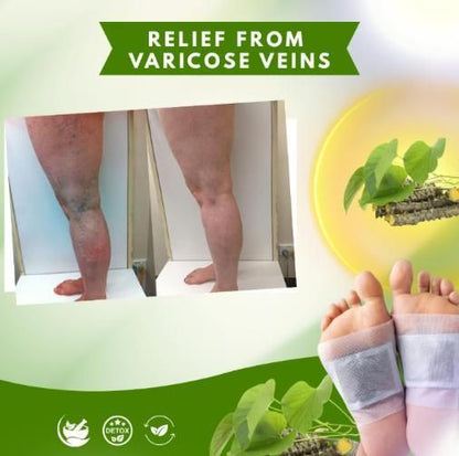 Herbal Giloy Patches 20pcs (Buy 🔥1 Get 1 Free🔥)⭐⭐⭐⭐⭐(4.9 Verified Reviews)