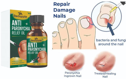 Anti Paronychia Relief Oil 10 ml Buy 1 Get 1 Free ⭐⭐⭐⭐⭐(4.9/5) (10000+ Verified Reviews)
