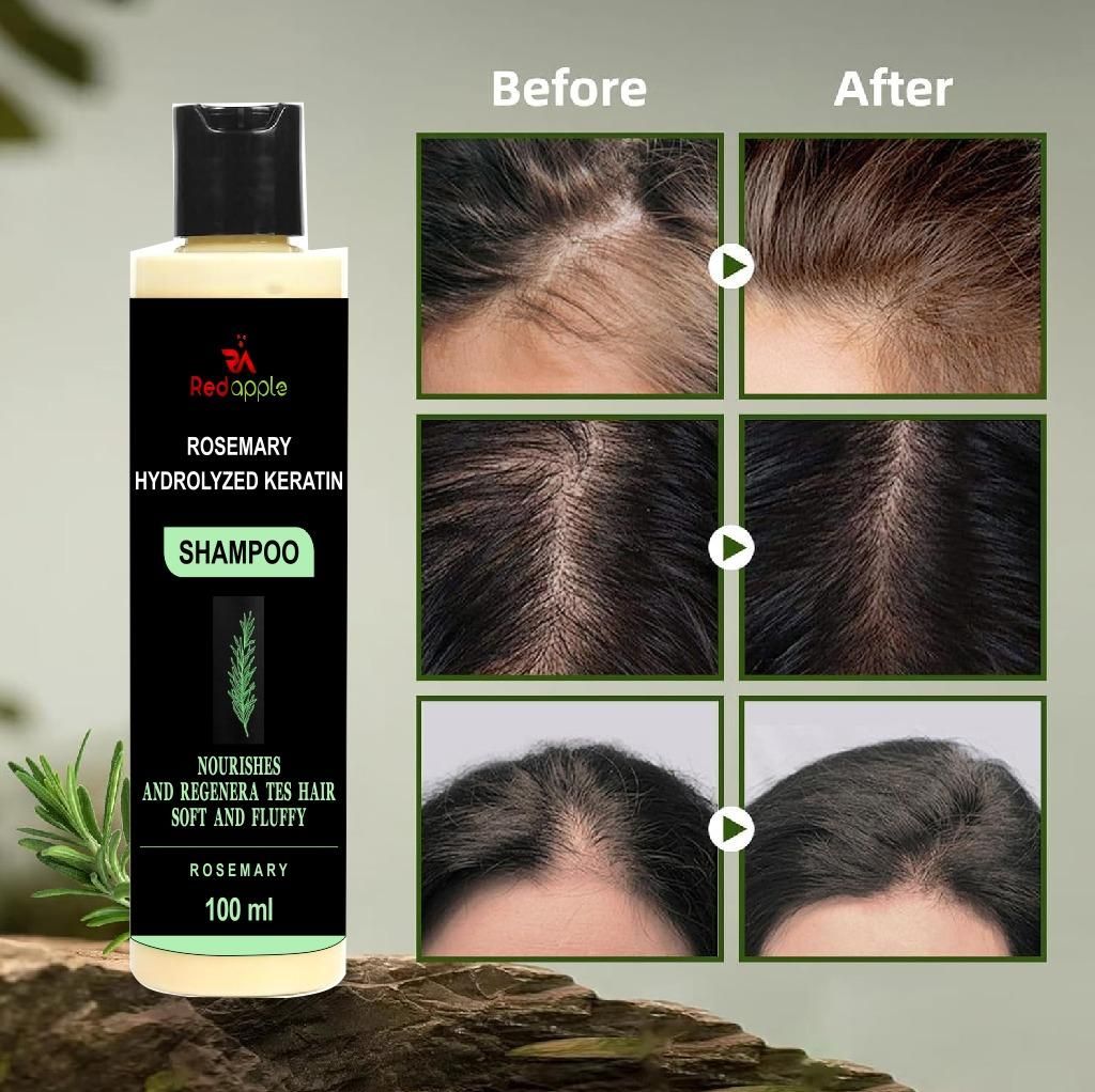 Rosemary Hydrolyzed Keratin Shampoo 200 ml (🔥Buy 1 Get 1 Free🔥)(⭐⭐⭐⭐⭐ (4.9/5) RATED BY 10,000+ CUSTOMERS)