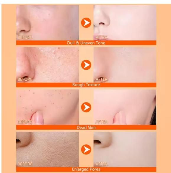 Exfoliating Kojic Acid Turmeric Spray 400 ml (Buy 🔥1 Get 1 Free 🔥)⭐⭐⭐⭐⭐(4.9 Verified Reviews)