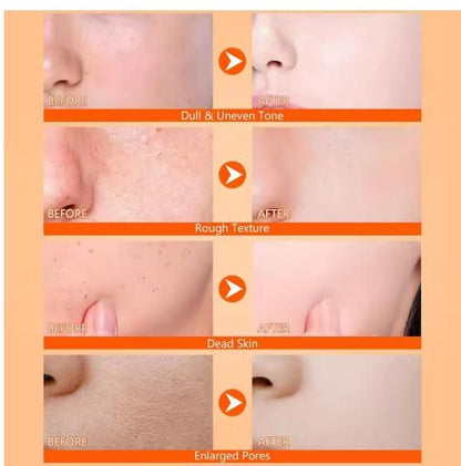 Exfoliating Kojic Acid Turmeric Spray 400 ml (Buy 🔥1 Get 1 Free 🔥)⭐⭐⭐⭐⭐(4.9 Verified Reviews)