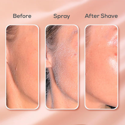 Magic Hair Identifier Spray + Free Face Razor ⭐⭐⭐⭐⭐(4.9/5) (10000+ Verified Reviews) INDIA'S
