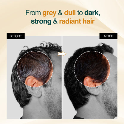 Rice Water Serum (⭐⭐⭐⭐⭐ (4.9/5) RATED BY 10,000+ CUSTOMERS)