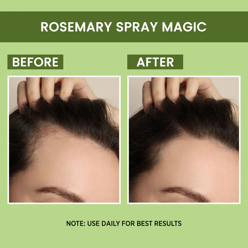 🌹 Original Rosemary Water, 𝗕𝗨𝗬 𝟭 𝗚𝗘𝗧 𝟭 𝗙𝗥𝗘𝗘  ⭐⭐⭐⭐⭐(4.6/5) (10000+ Verified Reviews)