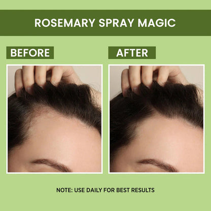 🌹 Original Rosemary Water, 𝗕𝗨𝗬 𝟭 𝗚𝗘𝗧 𝟭 𝗙𝗥𝗘𝗘  ⭐⭐⭐⭐⭐(4.6/5) (10000+ Verified Reviews)