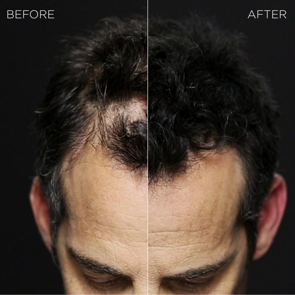 Toppik Hair Building Fibers, Keratin-Derived