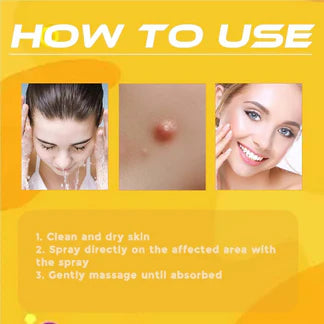 Bee Venom Skin Tag & Wart Remover Spray (BUY 1 GET 1 FREE) ⭐⭐⭐⭐⭐(4.9/5) (10000+ Verified Reviews)